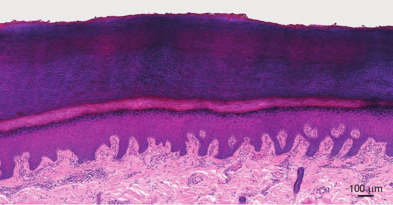 <p>15. The image shows a section from a histological specimen.</p><p>Which of the cell types found in this organ can differentiate into cells capable of presenting antigens to both CD4+ and CD8+ T-lymphocytes?</p><p>A. Granulocytes</p><p>B. Langerhans cells</p><p>C. Melanocytes</p><p>D. Merkel cells</p><p>E. Plasma cells</p>