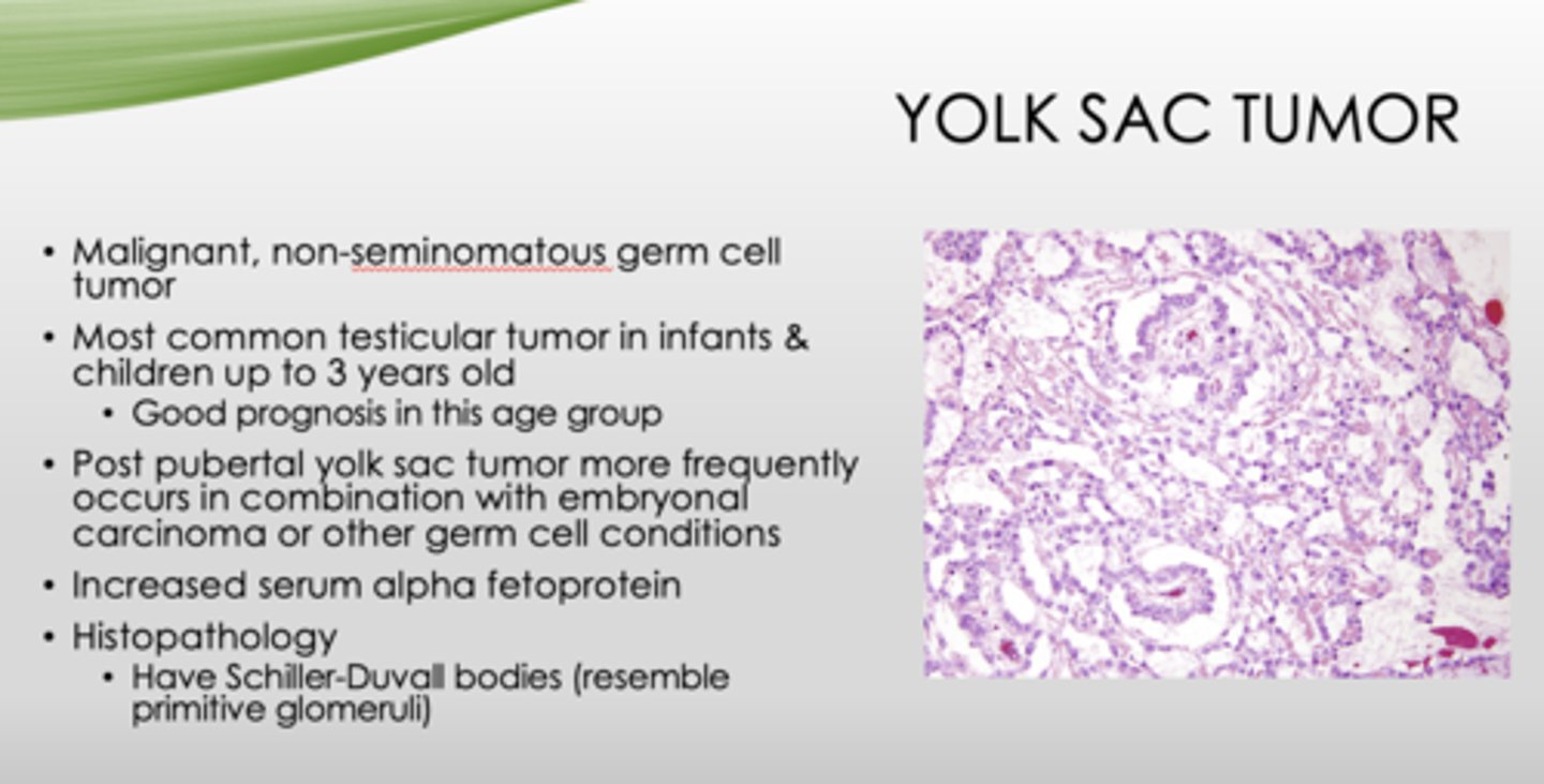 <p>yolk sac tumor</p>
