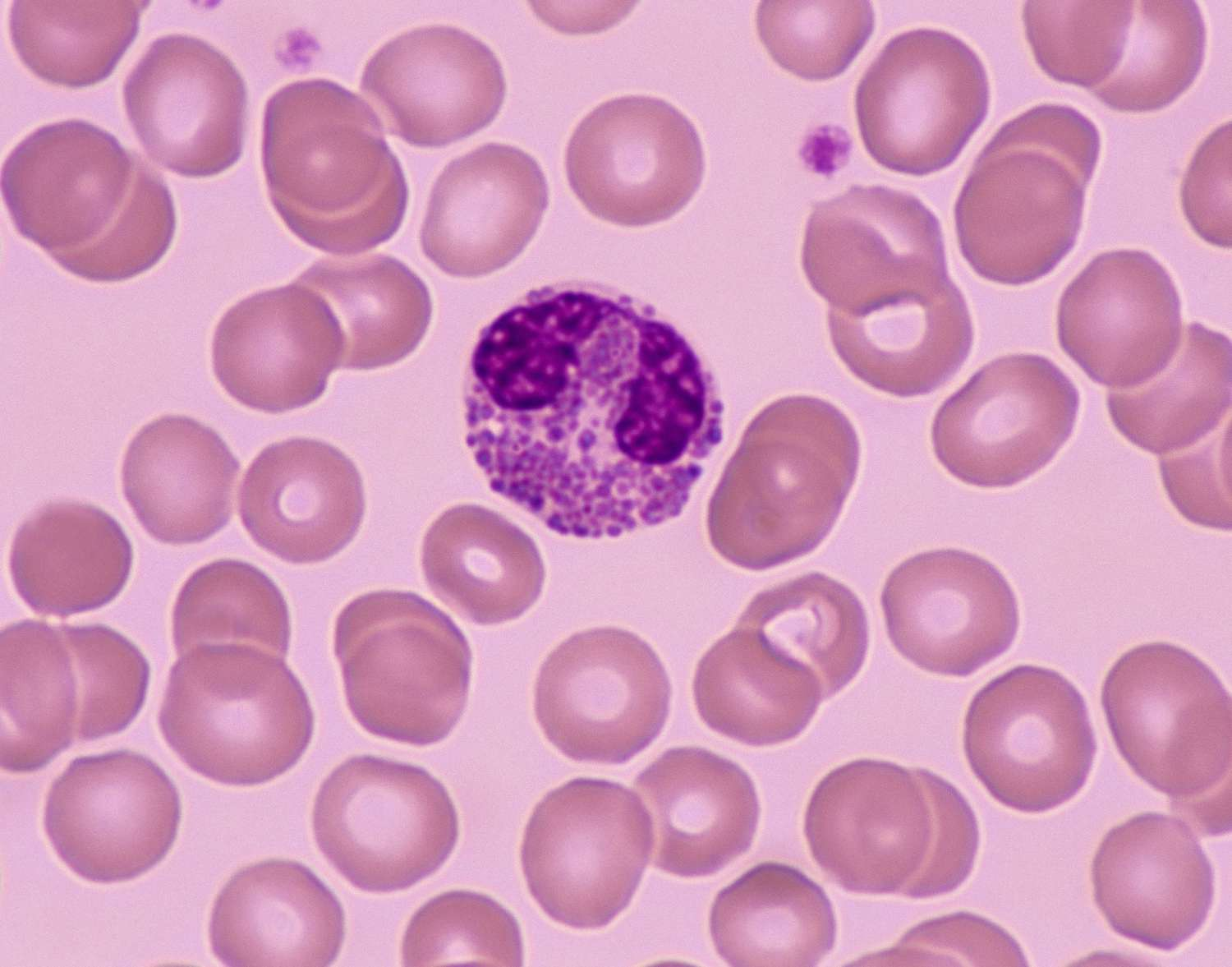 <p>What type of WBC is this?</p>
