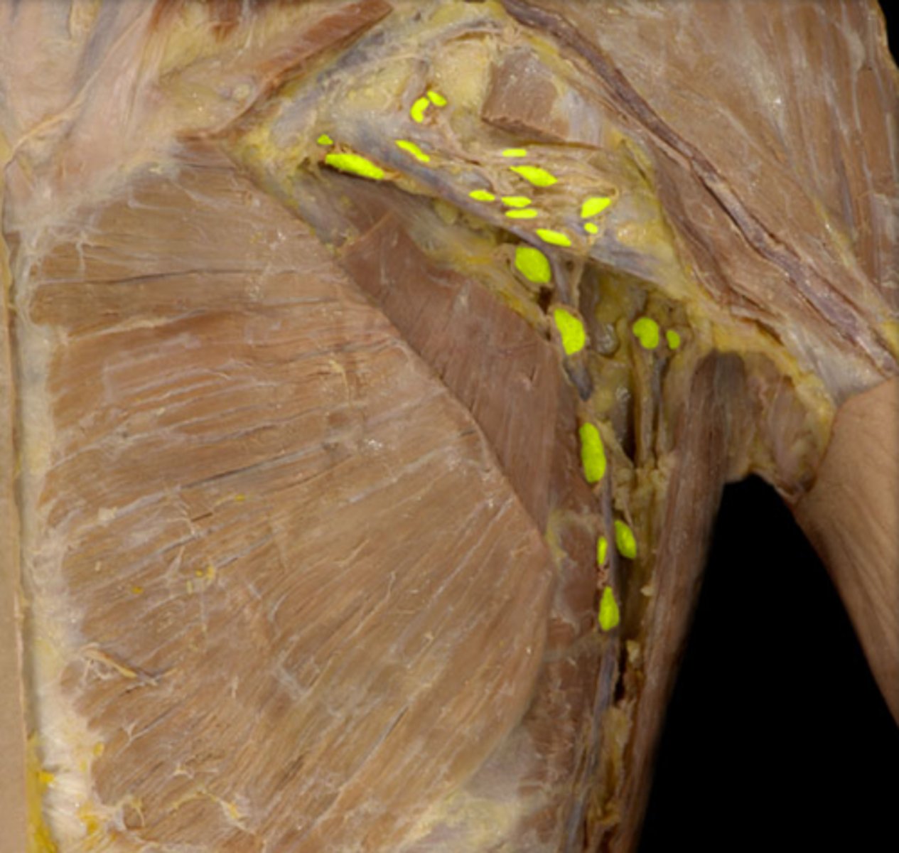 <p>Location: Large tissues in the axilla (armpit)</p><p>Description: Receives lymph from the upper limbs</p>