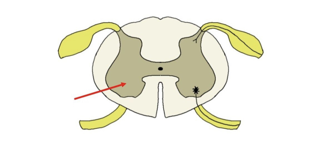 gray matter of the spinal cord containing multipolar motor neurons, sometimes referred to as the ventral horn