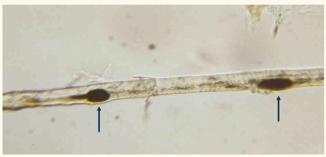 <p>What are these hair structures?</p>