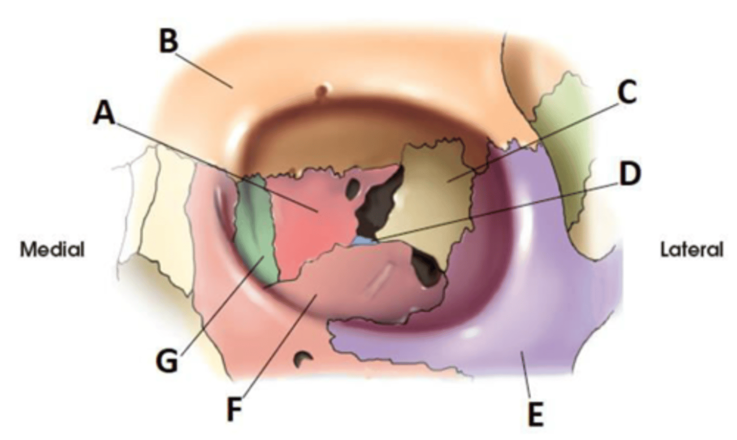 <p>a. ethmoid.</p>