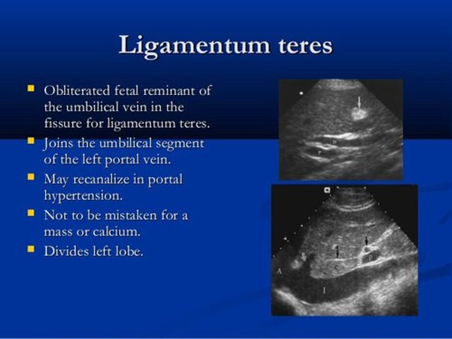 <p>It divides the inferior liver into right and left lobes and is a remnant of the left umbilical vein.</p>