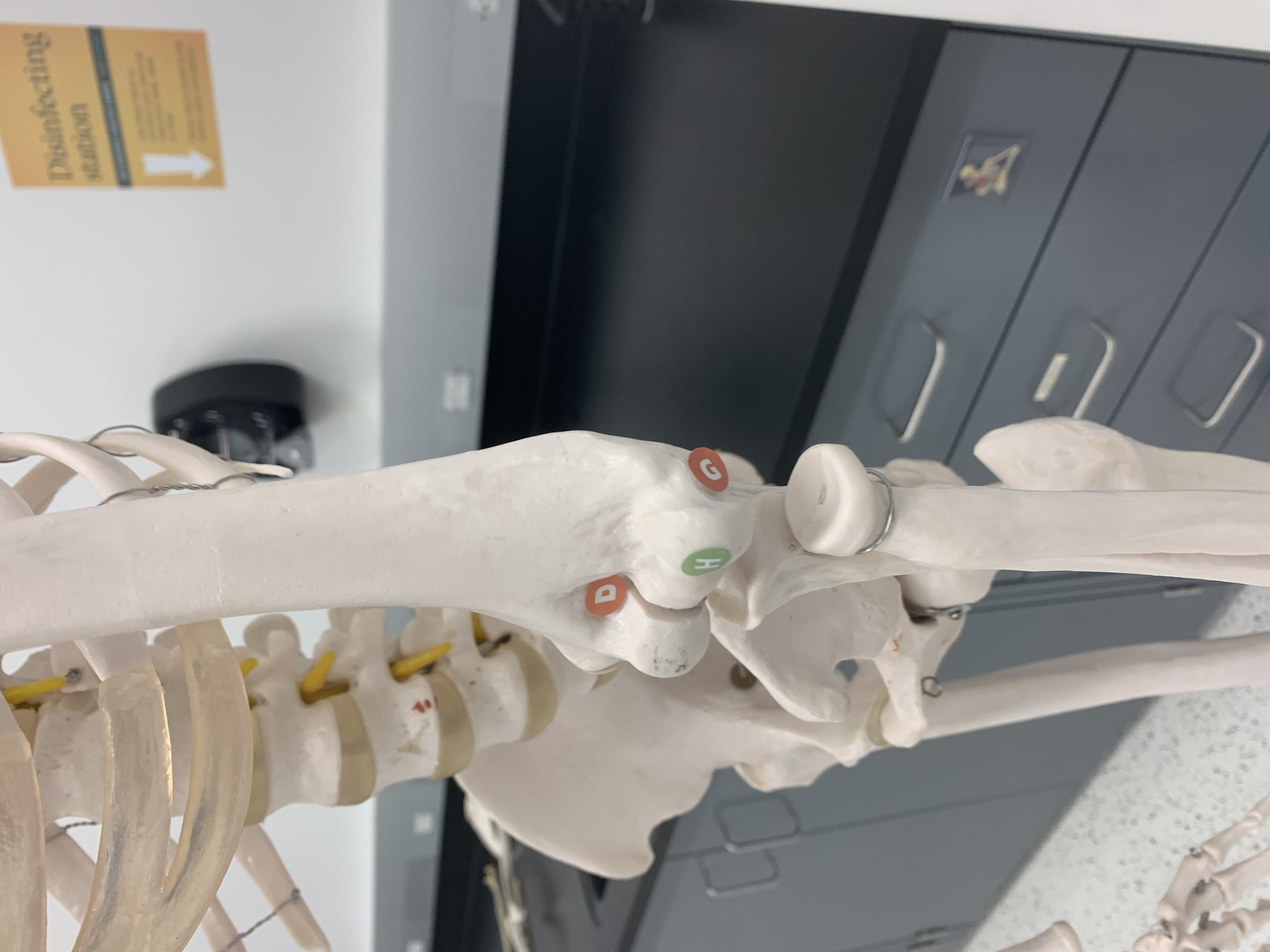 <p>Coronoid Fossa</p>