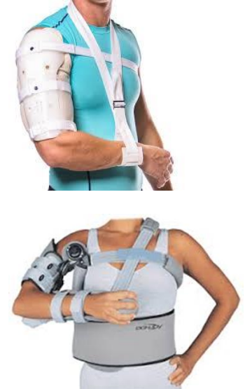 <p>Name this static elbow orthosis.</p>