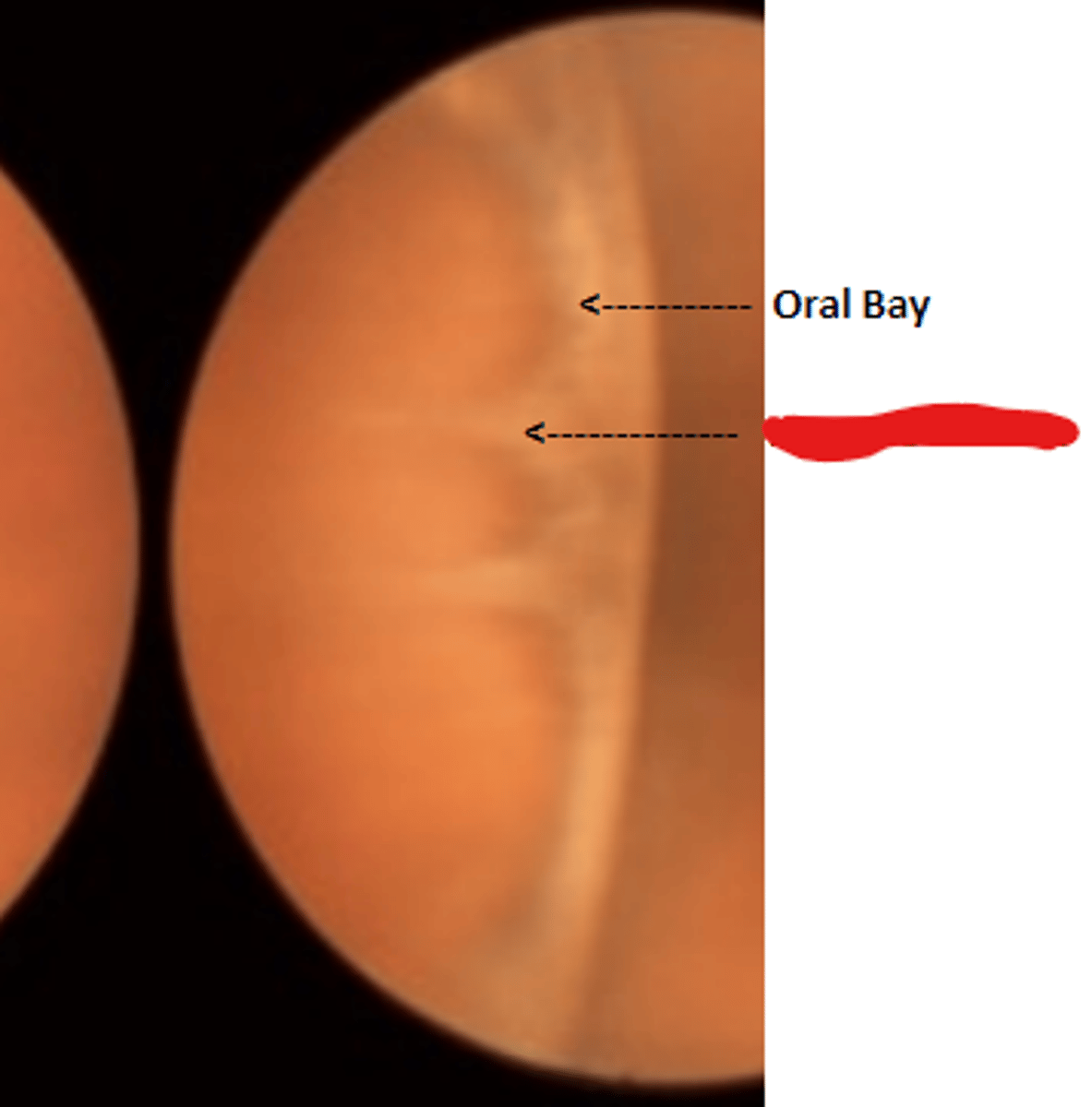 <p>white teeth like projections of the retina into the pars plana. Delineate oral bays.</p>