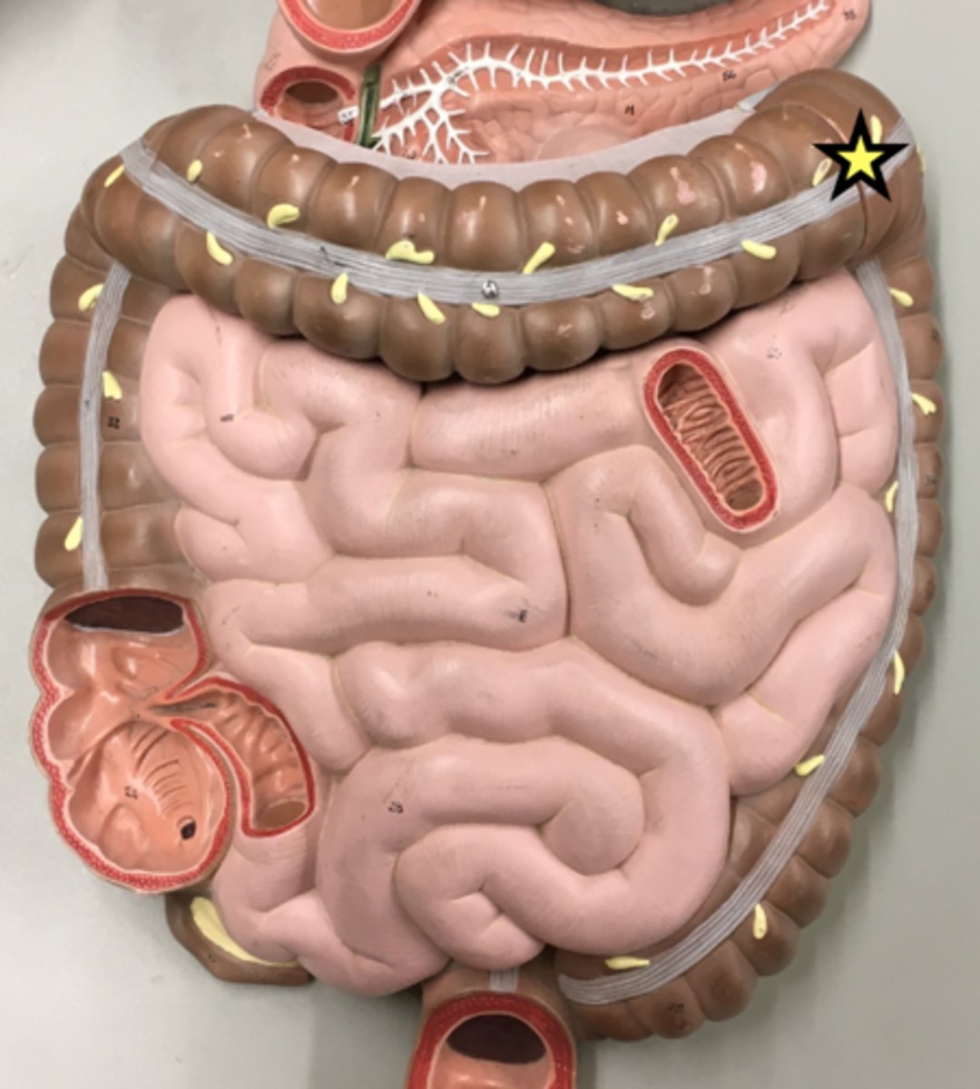 <p>Name this curvature (or turn)</p>