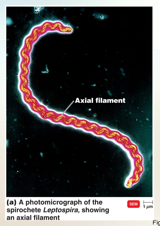 <p>Axial Filaments (Endoflagella)</p>