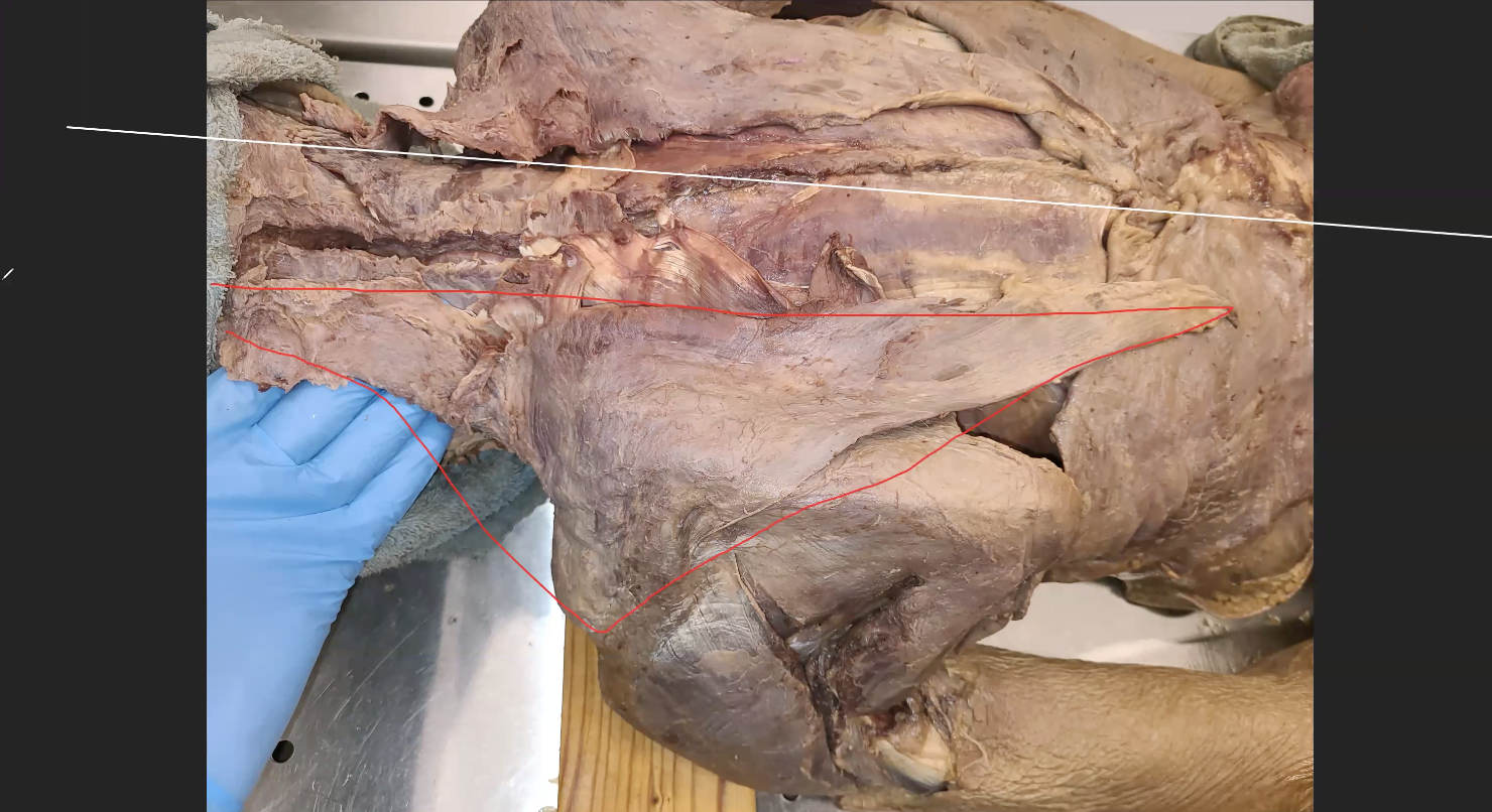 <p>what is the red line muscle </p>
