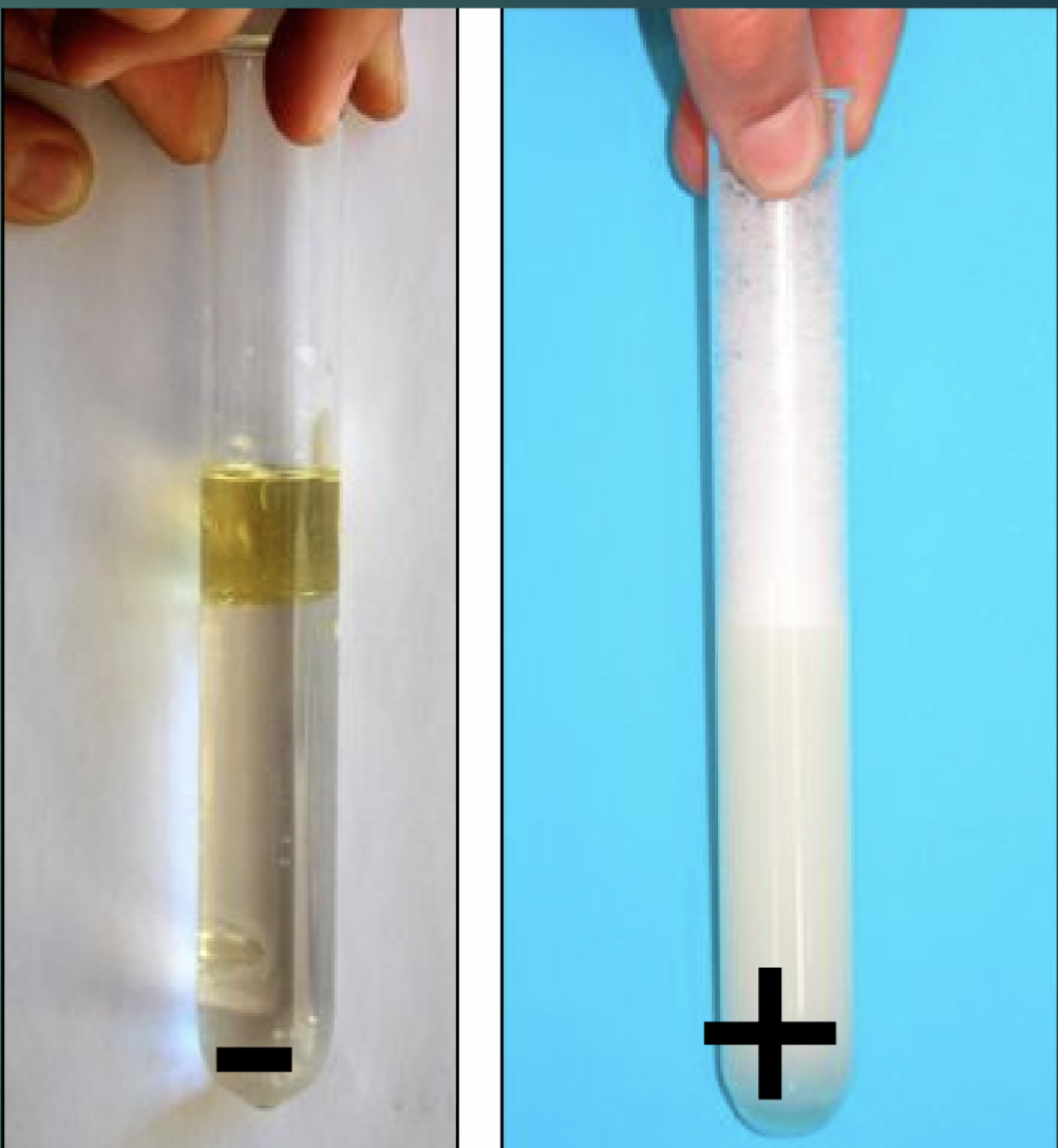 <p>Tween Test</p><ul><li><p>emulsifier pos (+): homogenous</p></li><li><p>emulsifier neg (-): seperated</p></li></ul><p></p>