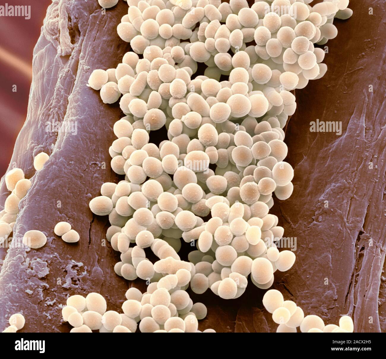 <p>Es un tipo de bacteria del ácido láctico que se usa para <mark data-color="yellow">fermentar y conservar alimentos</mark>. Nos ayuda a prevenir el crecimiento de otros patógenos en el intestino y a prevenir la enfermedad inflamatoria intestinal</p>