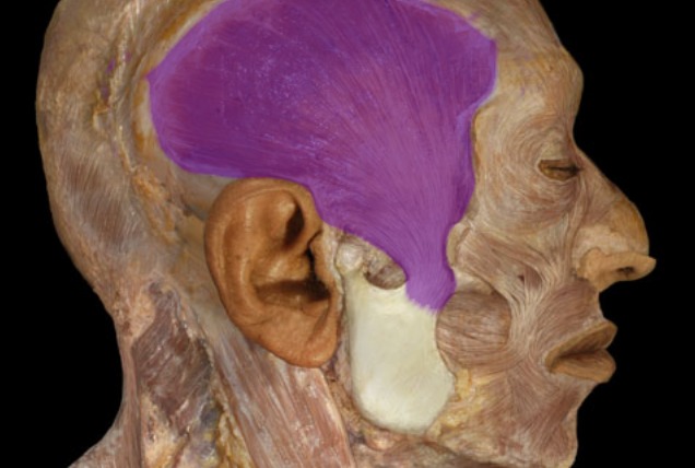 <p>side of head where temporalis bone is</p>