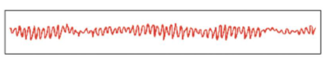 <p>Relaxation increases, and EEG shows increased amplitude</p>