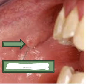 <p>What is the arrow pointing to?</p>