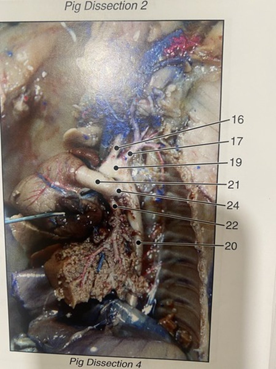 <p>a blood vessel in a fetus that bypasses pulmonary circulation by connecting the pulmonary artery directly to the ascending aorta (#24)</p>