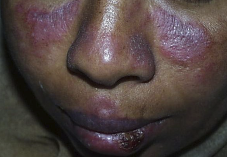 <p>What condition is this </p>