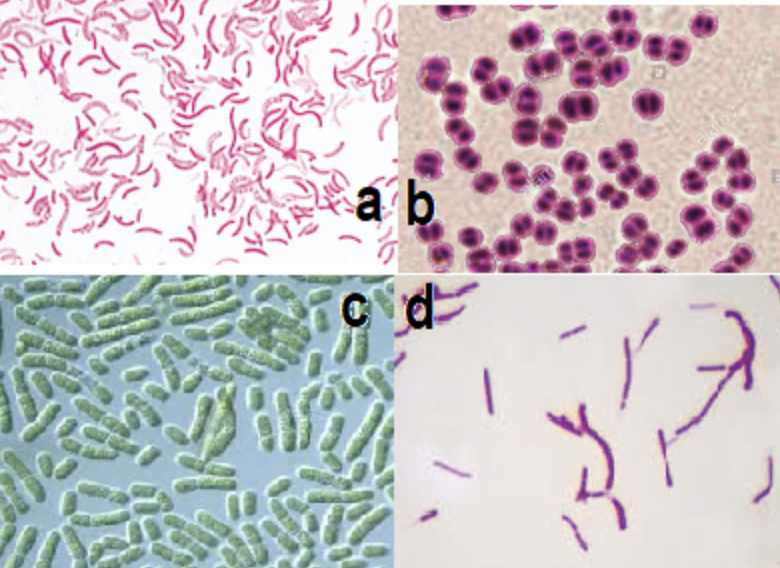 <p>which of these is the bacterium responsible for causing meningitis</p>