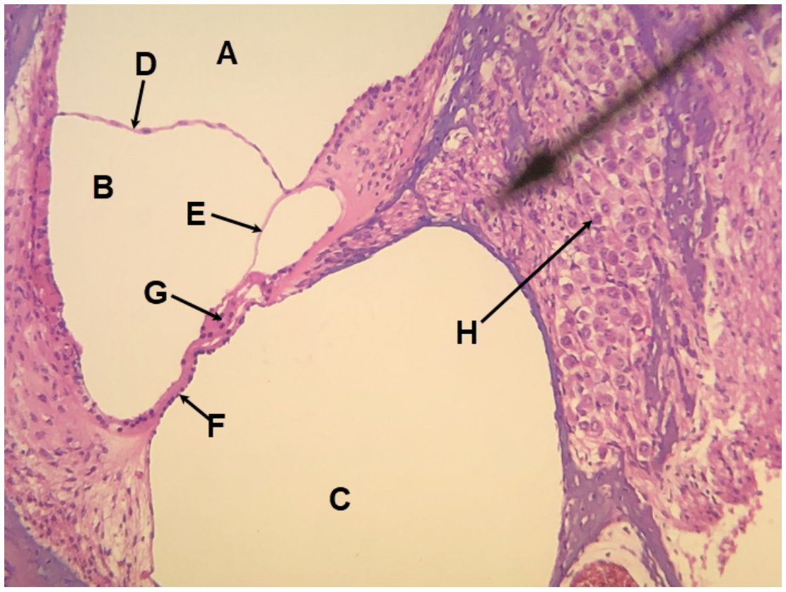 <p><span><span>In the image above, identify spaces A-C, and structures D-H.</span></span></p>