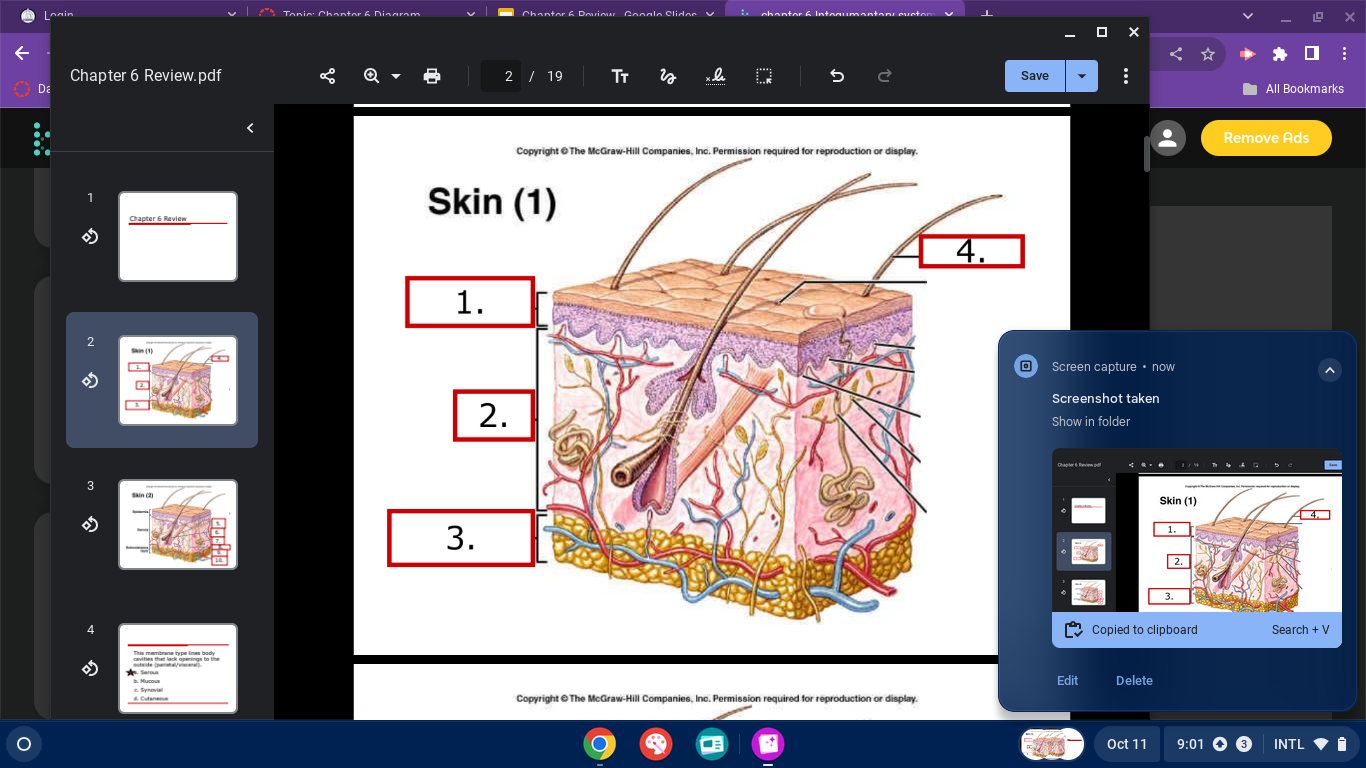 <p>skin diagram</p>