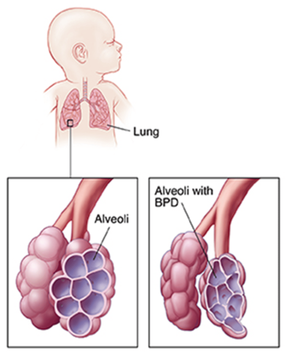 <p>Persisten hypoxia, chronic respiratory distress, retractions, tachycardia, rapid RR;</p><p>Tx: mechanical ventilation</p>