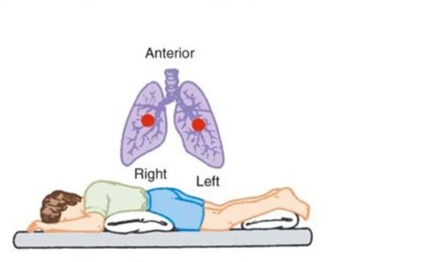 <p>- Position the patient prone with the bed flat.</p><p>- Area to percuss is just below the lower margin of the scapula.</p>