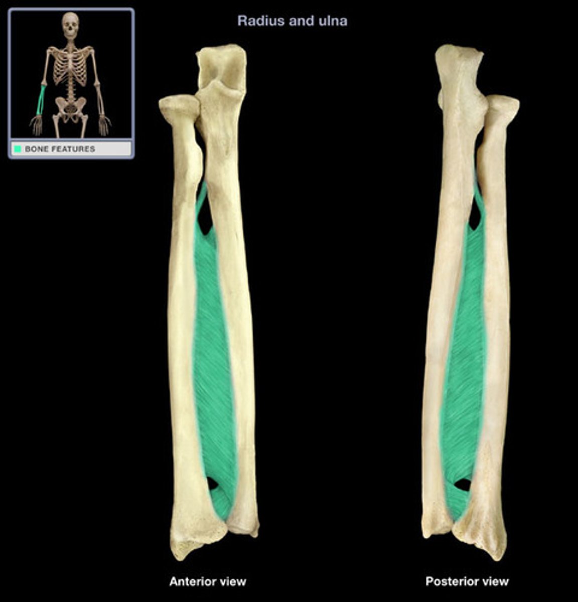 <p>sheet of collagen fibers that attach the shafts of two bones. between radius and ulna</p>