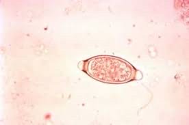 <p>This is found on a fecal sample from a sow.</p>