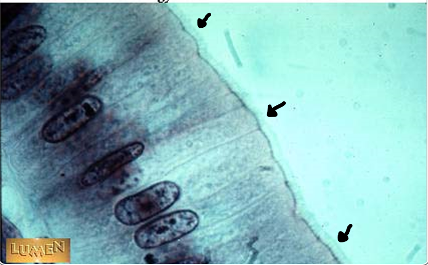 <p>the arrows point to</p>