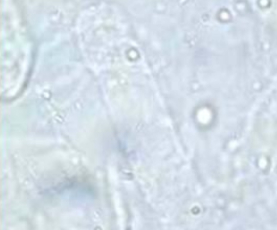 <p>made of Tamm-Horsfall mucoprotein</p>