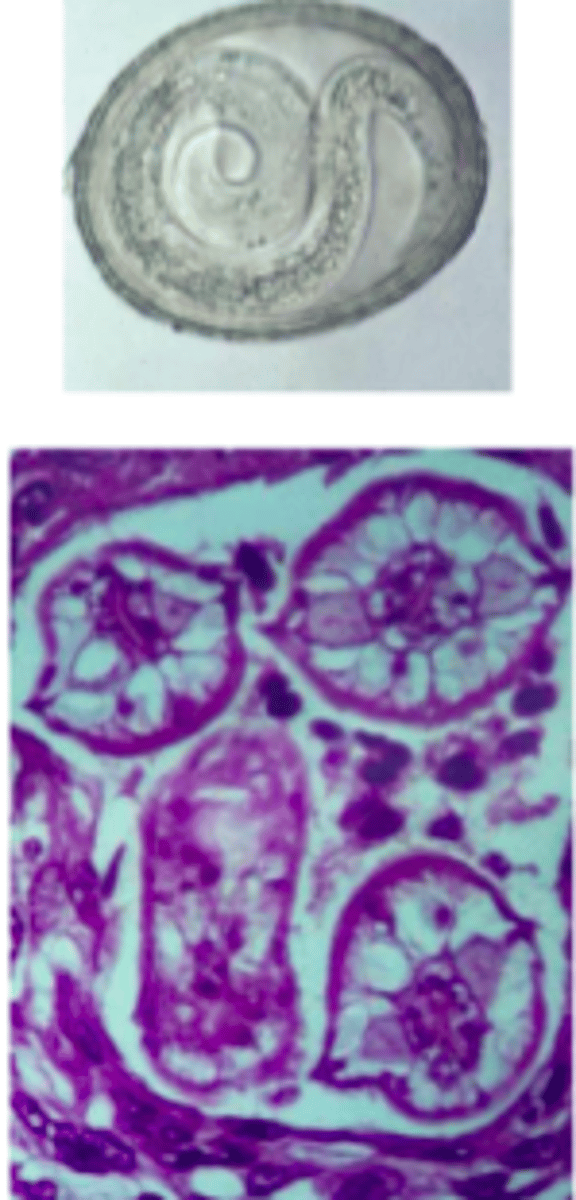 <p>Baylisascaris procyonis</p>