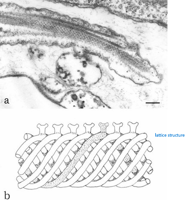 <ul><li><p>USE = provides support for the flagella; in the form of a complex lattice structure parallel to the axoneme/flagella</p></li><li><p>aka Paraflagellar Rod (PFR)</p></li><li><p>present in Heterokonts, Euglenophytes, and Dinophytes</p></li></ul><p></p>