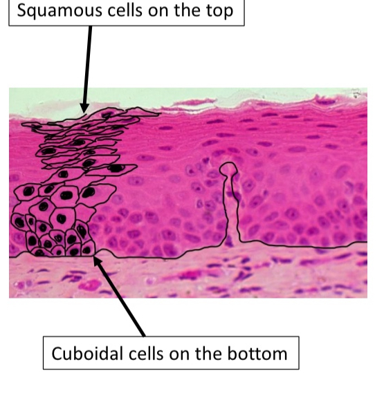 <ul><li><p>Squamous cells</p></li><li><p>Vagina</p></li></ul><p></p>