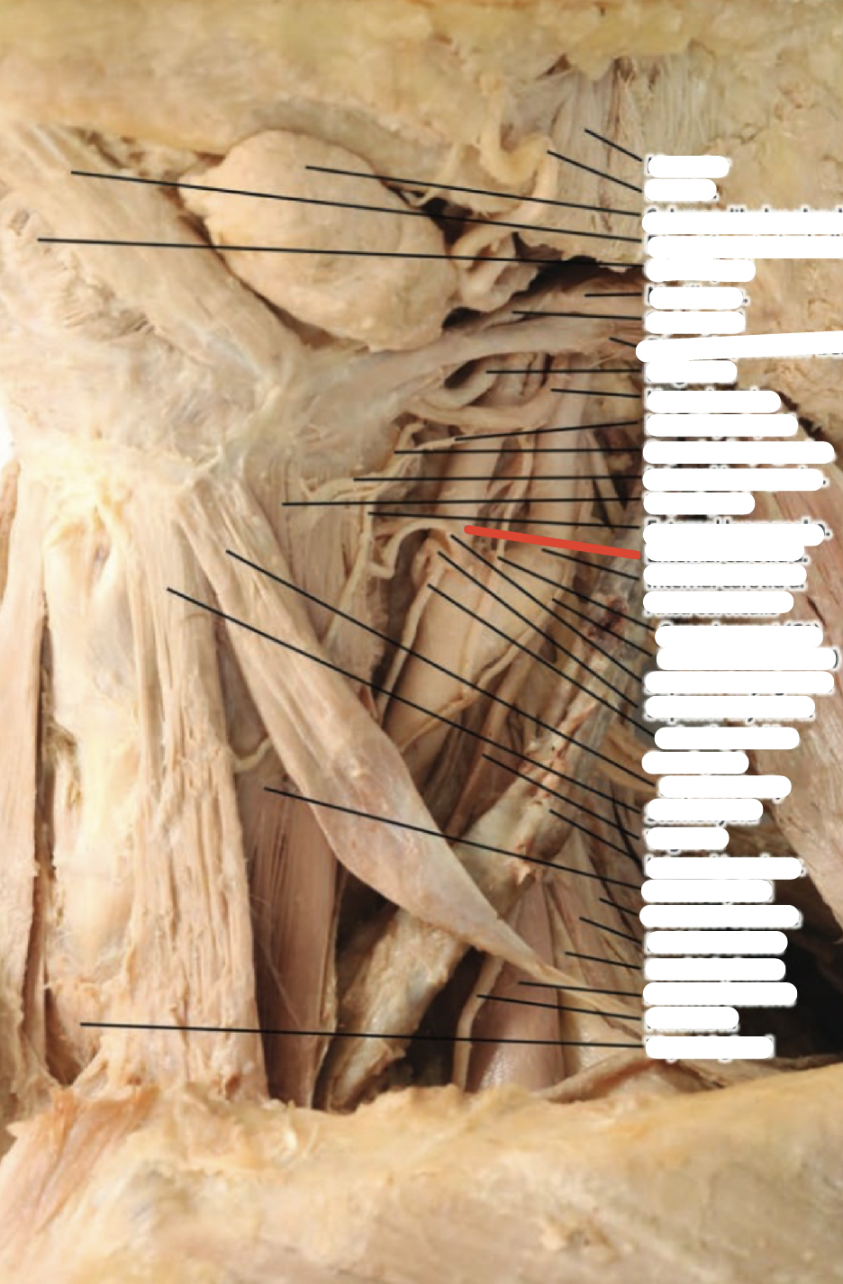 Identify the structure (red line)