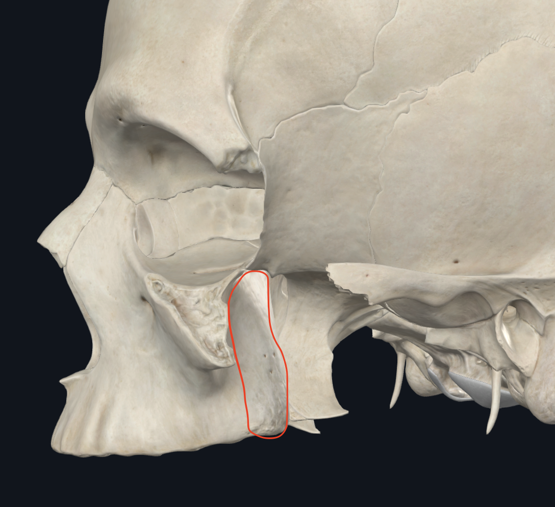 <p><strong>pared anterior de la hendidura pterigomaxilopalatina</strong></p><p><strong>(Todo lo que se encuentra posterior a la apófisis cigomática)</strong></p>