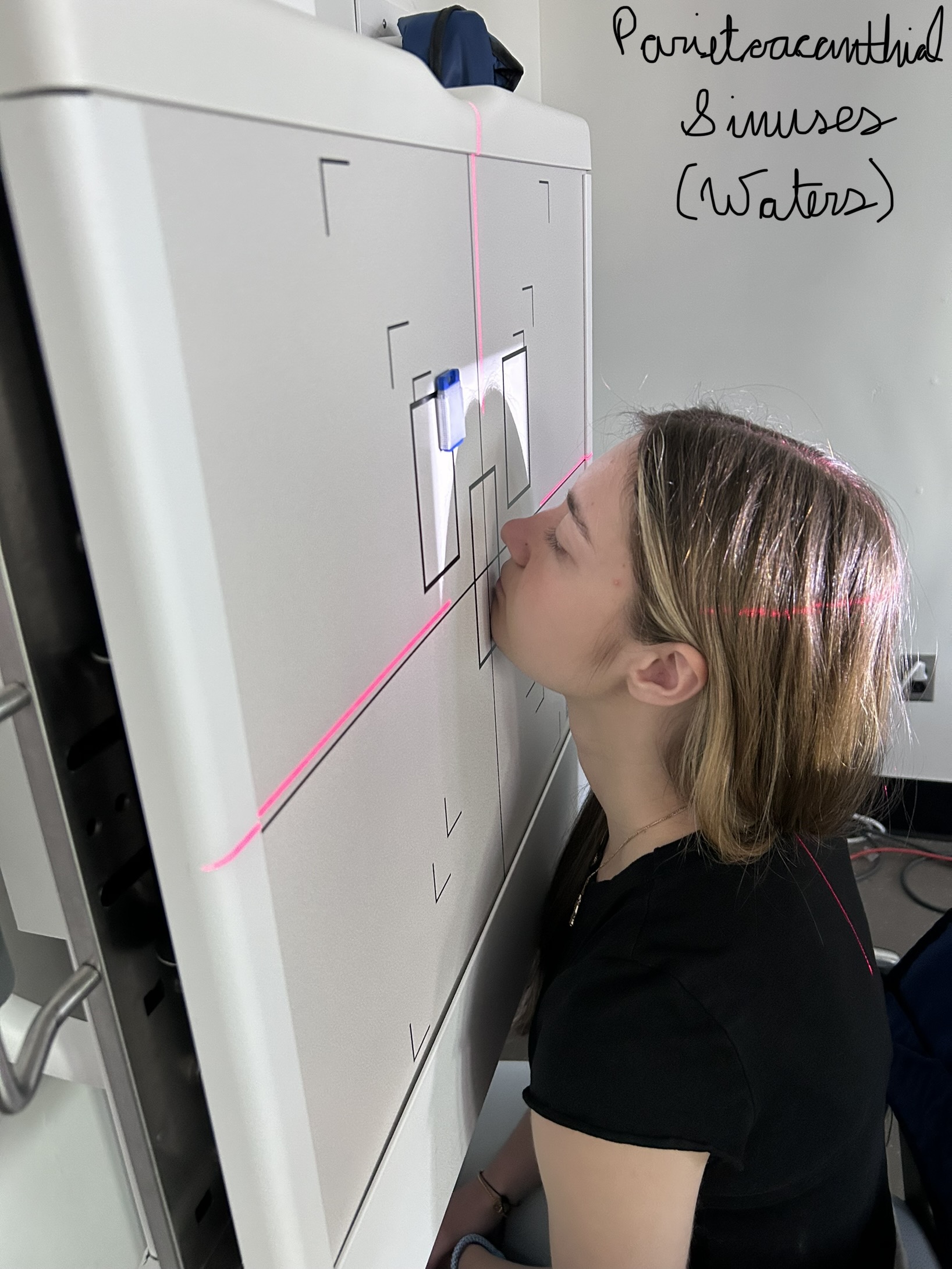 40” SID, 8” x 10” lw collimation, chin in contact with bucky, MML perpendicular to IR, OML in a 37º relationship with IR, Central ray exiting through the acanthion