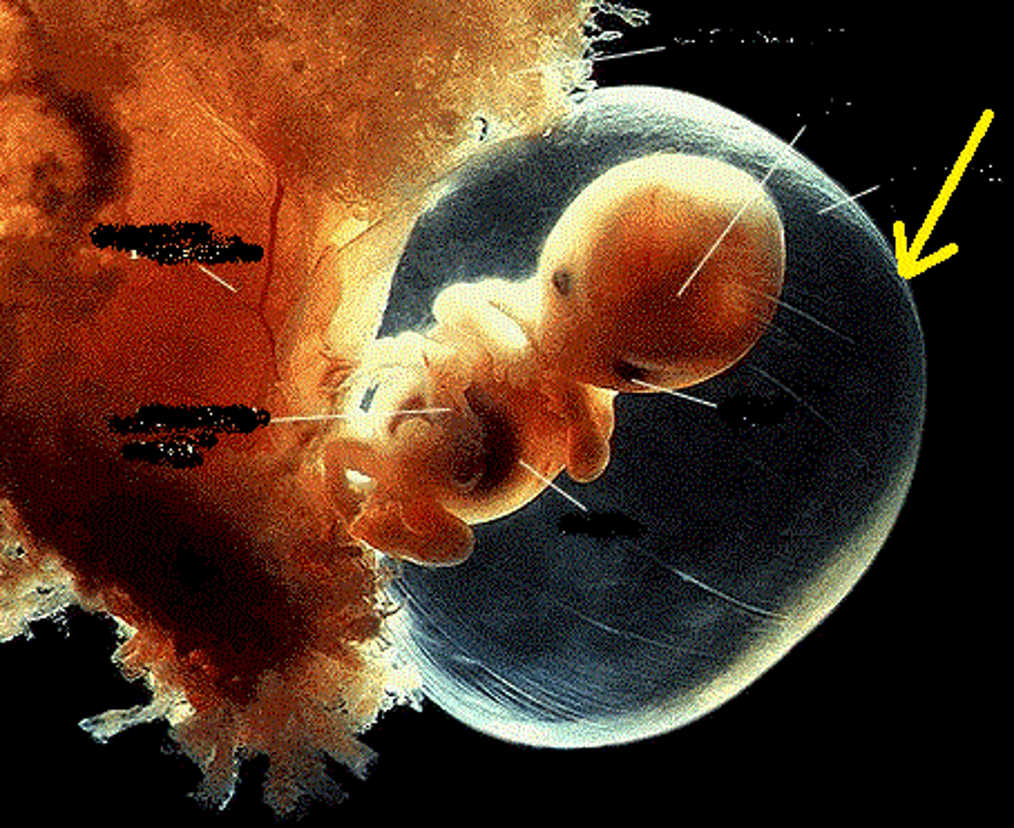 <p>term for a fluid-filled sac that cushions and protects a developing embryo and fetus</p>