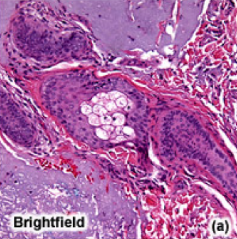 <p>Standard direct light microscopy.</p><p>Capable of viewing living and fixed specimens by using visible light and optical lenses to magnify an image.</p><p>Staining or natural pigmentation can provide image contrast, whilst the Koehler illumination technique ensures uniform specimen lighting.</p><p>Also, can’t see internal mechanisms with this unless fixation</p>
