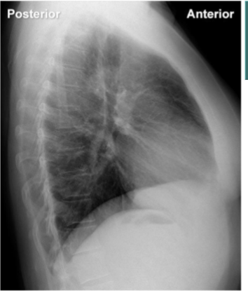 <p>identify hemi diagrams (2) and stomach bubble </p>