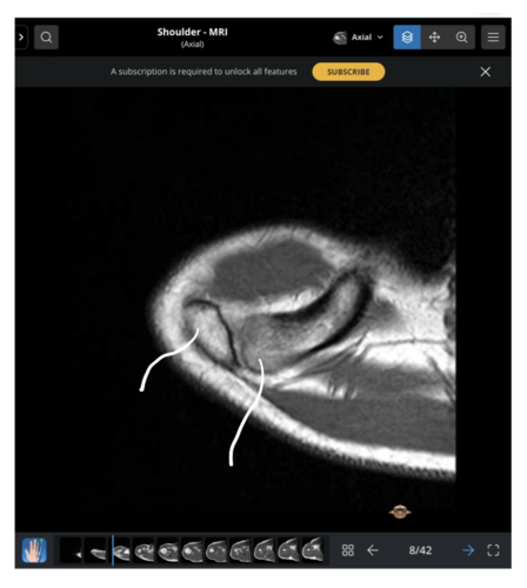 <p>From left to right, which structures are being pointed to in this image?</p>