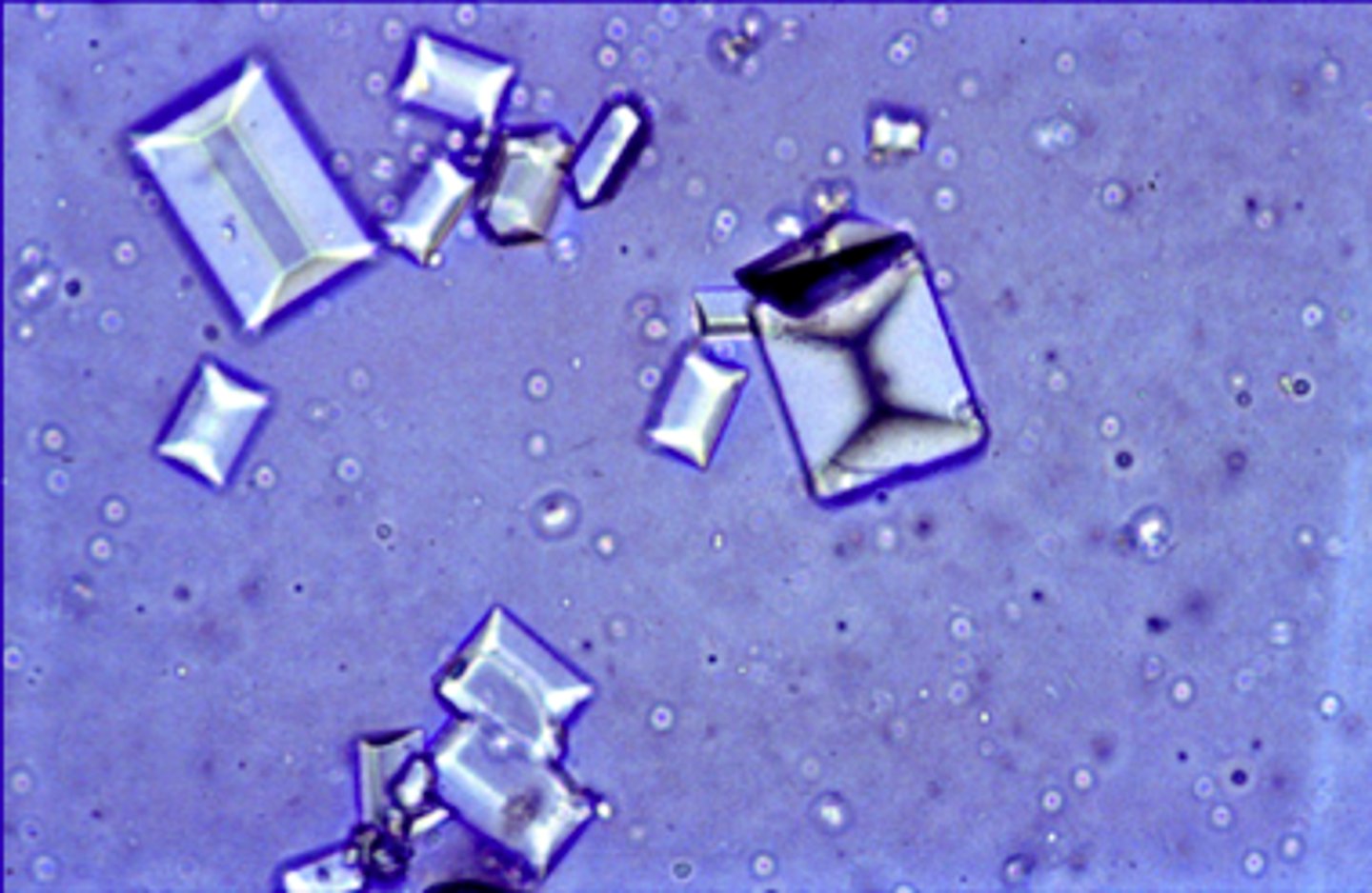 <p>alkaline urine, "coffin lids", colorless</p>