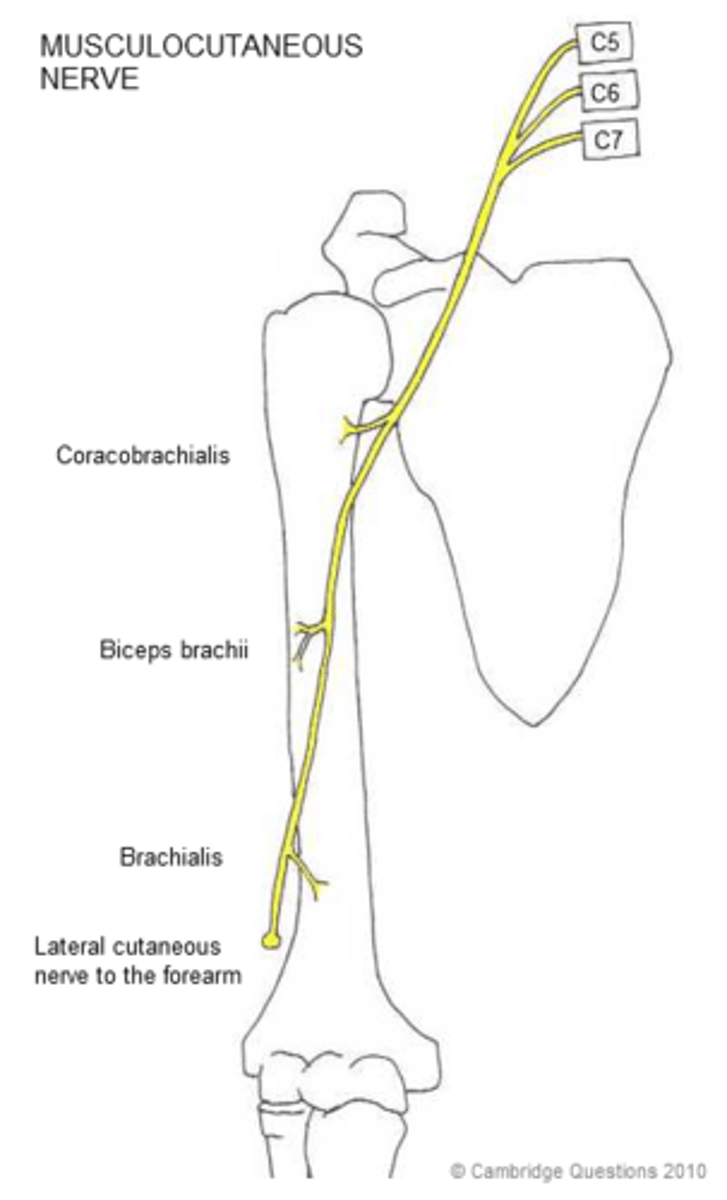 <p>Spinal Roots: C5-C7</p><p>Cause of Injury:</p><p>- upper trunk compression</p><p>Presentation:</p><p>- loss of forearm flexion and supination (biceps)</p><p>- loss of sensation over lateral forearm</p>
