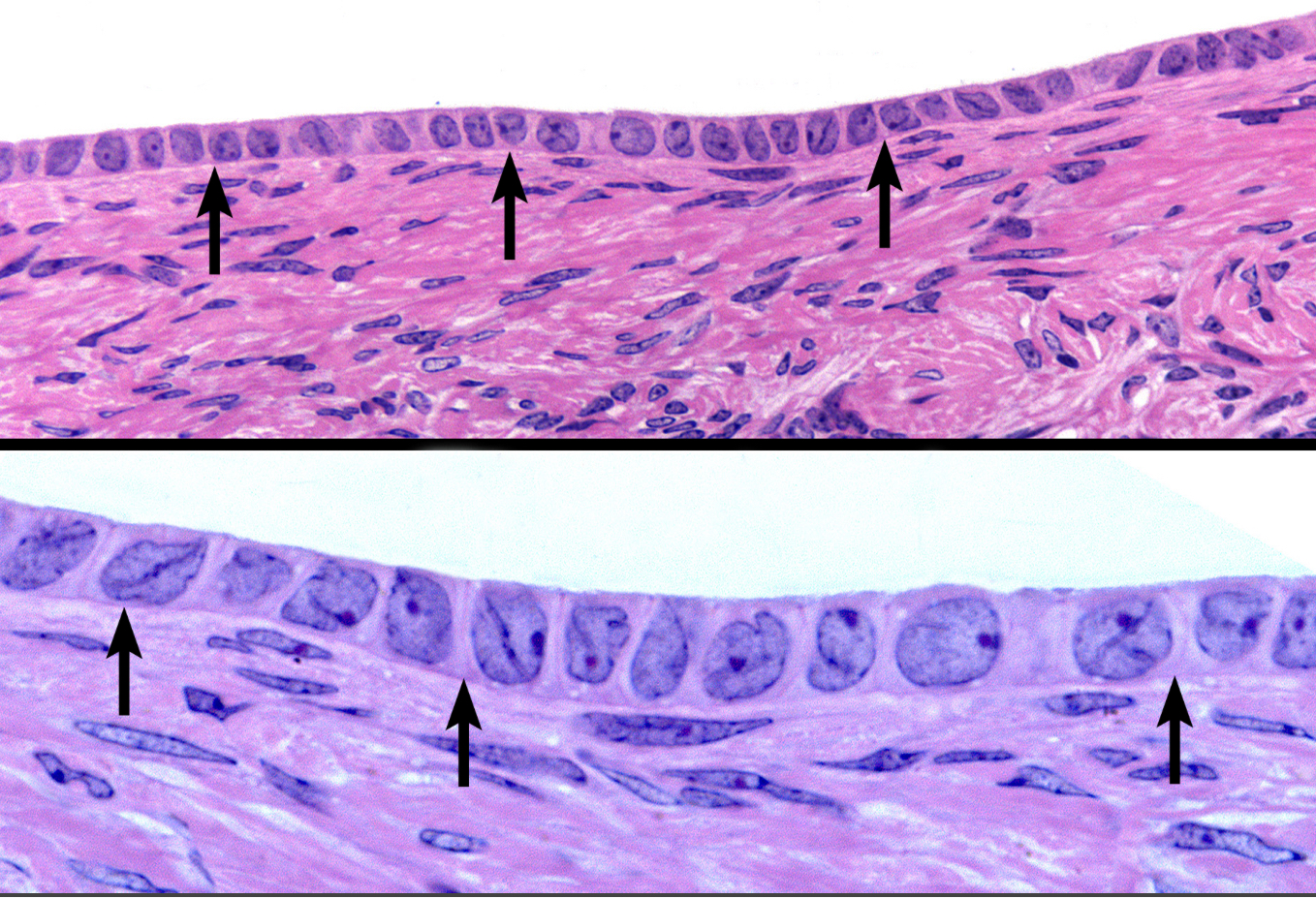 <p>Basal Surface</p>