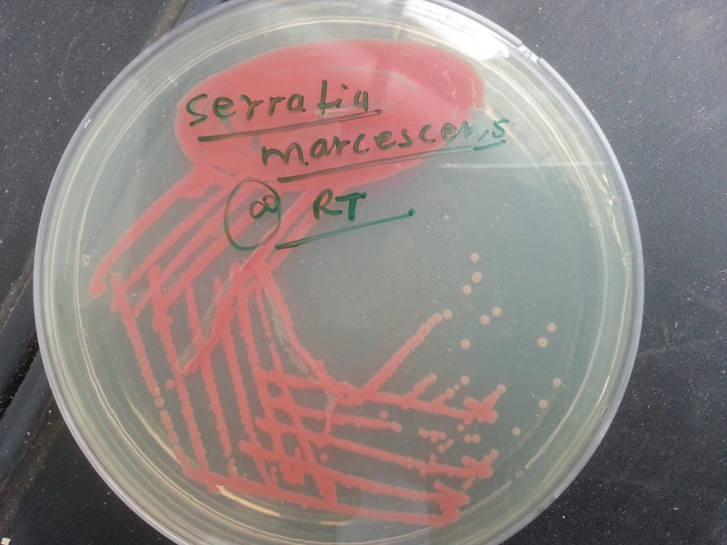 <p>C. <em>Serratia marcescens</em></p><div data-type="horizontalRule"><hr></div><ul><li><p><span data-name="check_mark_button" data-type="emoji">✅</span> <strong>C. <em>Serratia marcescens</em></strong> – Produces a <strong>red pigment</strong> called <strong>prodigiosin</strong>, especially at room temperature.</p></li><li><p><span data-name="cross_mark" data-type="emoji">❌</span> <strong>A. <em>Pseudomonas aeruginosa</em></strong> – Produces <strong>blue-green pigment</strong> (pyocyanin) and sometimes yellow-green (fluorescein).</p></li><li><p><span data-name="cross_mark" data-type="emoji">❌</span> <strong>B. <em>Staphylococcus aureus</em></strong> – Produces <strong>golden-yellow colonies</strong>, not red.</p></li><li><p><span data-name="cross_mark" data-type="emoji">❌</span> <strong>D. <em>Proteus mirabilis</em></strong> – Known for <strong>swarming motility</strong>, not pigment production.</p></li></ul><p></p>