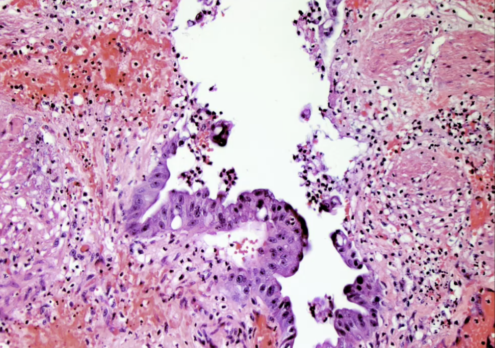 term image