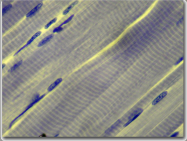 <p>attached to every bone of the skeletal system and to portions of the skin</p>