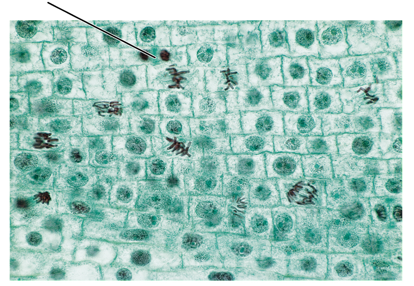 <p>What stage of mitosis is shown by these cells?</p><p>(Longitudinal section of an onion root tip).</p>