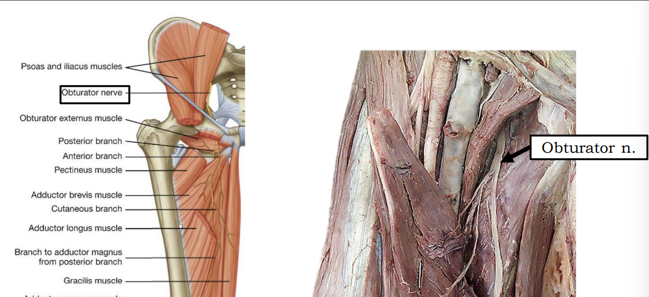<p>Obturator n. (lumbar plexus)</p>