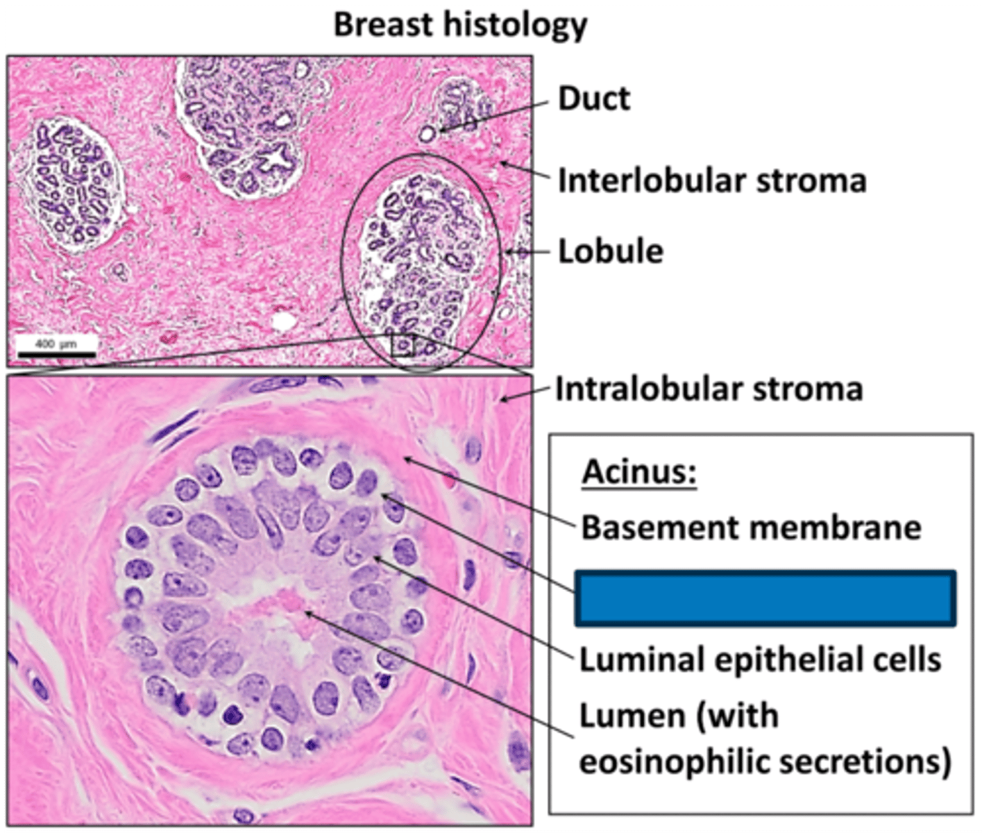 <p>What cells in the OUTER cell layer of the lobules of the TDLU that contract to propel milk?</p>