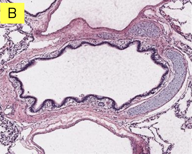 <p>Bronchus </p>